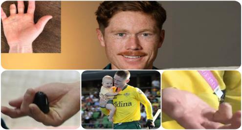 هذا لا يحدث كل يوم .. لاعب يبتر إصبعه من أجل المشاركة مع بلاده في أولمبياد باريس (صور)